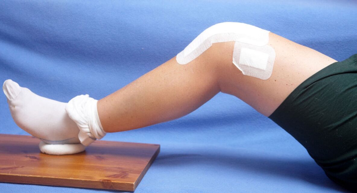 повреда на коленото како причина за артроза
