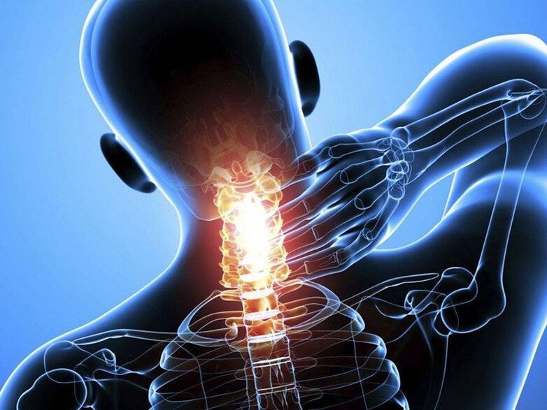 Остеохондрозата на цервикалниот 'рбет е придружена со болка во вратот