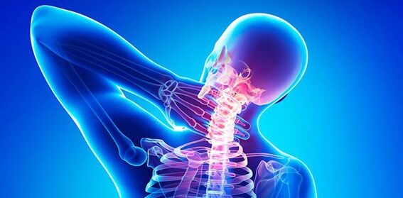 симптоми на болка во вратот